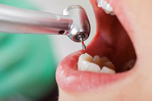 Best Cosmetic Emergency Dentistry in Monroe, OH